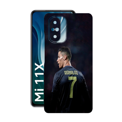 Защитная пленка StatusSKIN для Xiaomi Mi 11x 2021