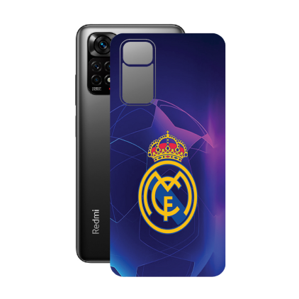 Захисна плівка StatusSKIN для Xiaomi Redmi Note 11s